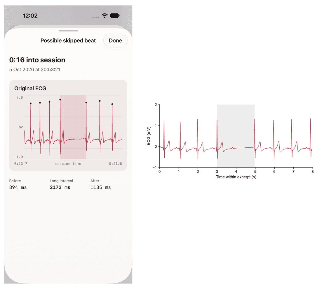 Sympathetic App Uses Polar H10 for Breathing Coach