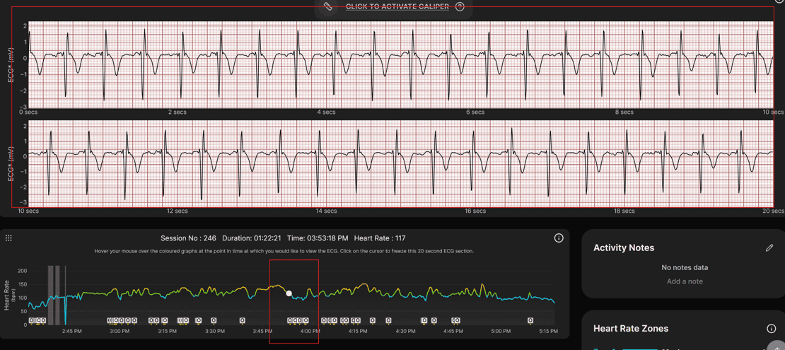 Fitbit Air vs Whoop MG Heart Rate Accuracy: HYROX and Z2 Ride Data
